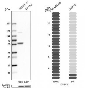 Anti-DSTYK antibody produced in rabbit 