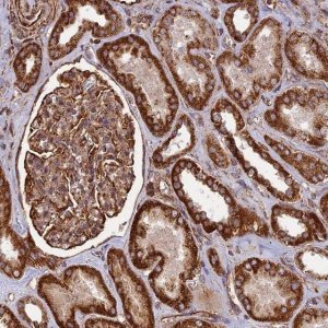 Anti-DSTYK antibody produced in rabbit 