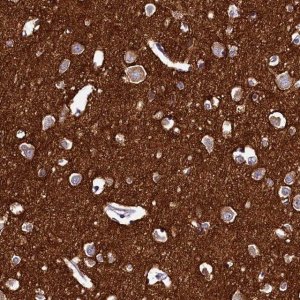 Anti-DTD1 antibody produced in rabbit HPA040981-100UL