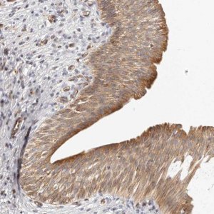 Anti-DTNBP1 antibody produced in rabbit HPA029615-100UL