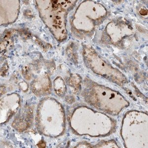 Anti-DUOX1 antibody produced in rabbit 
