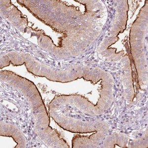 Anti-DUOXA2 antibody produced in rabbit 