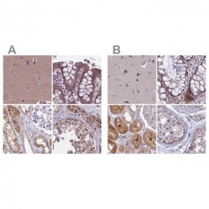 Anti-DUS2 antibody produced in rabbit 