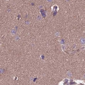 Anti-DUS2 antibody produced in rabbit 