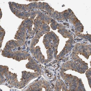 Anti-DUSP14 antibody produced in rabbit HPA019911-100UL