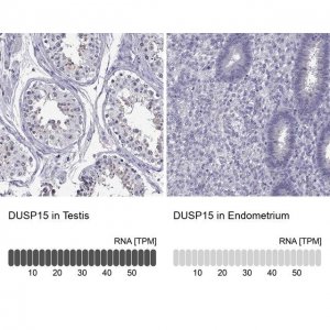 Anti-DUSP15 antibody produced in rabbit 