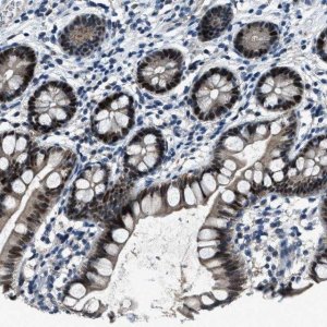 Anti-DUSP19 antibody produced in rabbit 