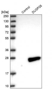 Anti-DUSP26 antibody produced in rabbit HPA018221-100UL
