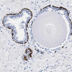 Anti-DUSP26 antibody produced in rabbit HPA018221-100UL