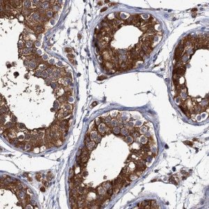 Anti-DYDC1 antibody produced in rabbit 