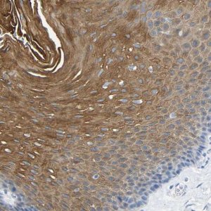 Anti-DYNAP antibody produced in rabbit 