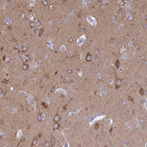 Anti-DYNC1I1 antibody produced in rabbit 