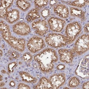 Anti-DYNC1I2 antibody produced in rabbit 