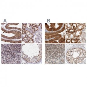 Anti-DYRK4 antibody produced in rabbit 