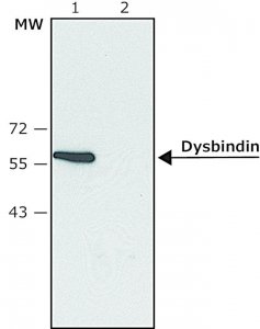 Anti-Dysbindin (C-terminal) antibody produced in rabbit SAB4200486-200UL