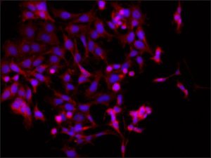 Anti-Dysbindin (C-terminal) antibody produced in rabbit SAB4200486-200UL