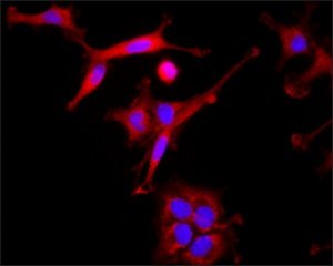 Anti-Dysbindin antibody produced in rabbit SAB4200409-200UL
