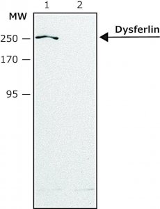 Anti-Dysferlin (N-terminal region) antibody produced in rabbit SAB4200388-200UL