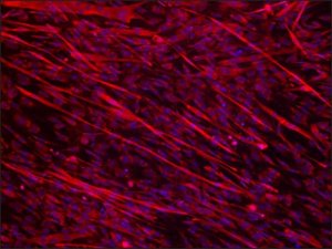 Anti-Dysferlin (N-terminal region) antibody produced in rabbit SAB4200388-200UL