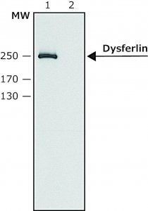 Anti-Dysferlin (N-terminal) antibody produced in rabbit SAB4200453-200UL