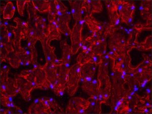 Anti-Dysferlin (N-terminal) antibody produced in rabbit SAB4200453-200UL