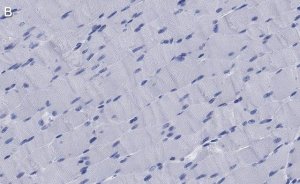 Anti-Dystrophin Antibody, clone 1G7, ZooMAb Rabbit Monoclonal 