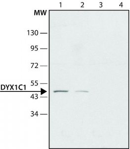 Anti-DYX1C1 antibody produced in rabbit 