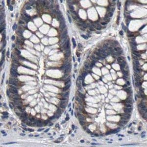 Anti-EBAG9 antibody produced in rabbit 
