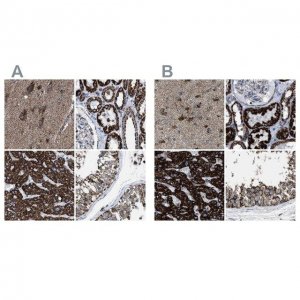 Anti-ECHS1 antibody produced in rabbit 