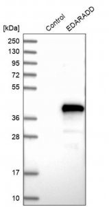 Anti-EDARADD antibody produced in rabbit 