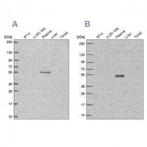 Anti-EED antibody produced in rabbit 