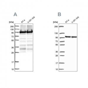 Anti-EEF2 antibody produced in rabbit 