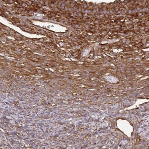 Anti-EEF2 antibody produced in rabbit 
