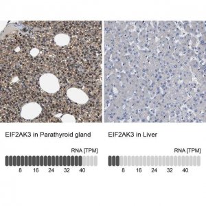 Anti-EIF2AK3 antibody produced in rabbit 