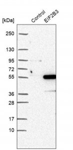 Anti-EIF2B3 antibody produced in rabbit 