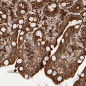 Anti-EIF2B3 antibody produced in rabbit 