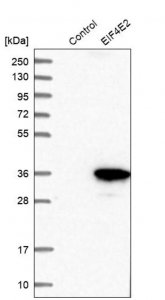 Anti-EIF4E2 antibody produced in rabbit HPA019253-100UL