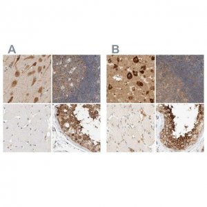 Anti-EIF4G3 antibody produced in rabbit 