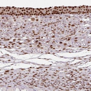 Anti-ELK1 antibody produced in rabbit 