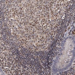Anti-ELK3 antibody produced in rabbit 
