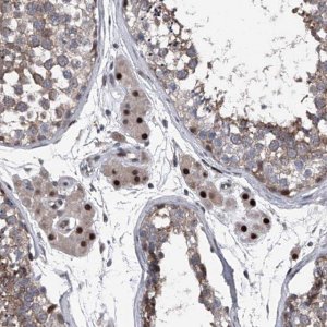Anti-ELK4 antibody produced in rabbit 