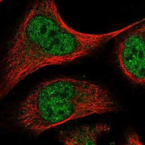 Anti-ELK4 antibody produced in rabbit 