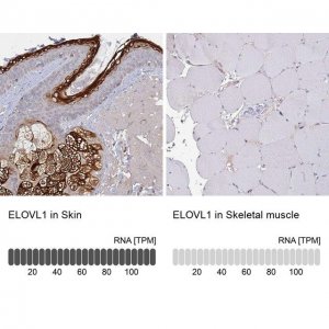 Anti-ELOVL1 antibody produced in rabbit 