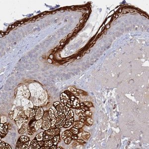 Anti-ELOVL1 antibody produced in rabbit 