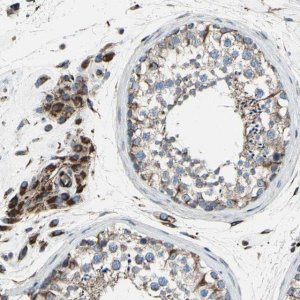 Anti-EMC7 antibody produced in rabbit 