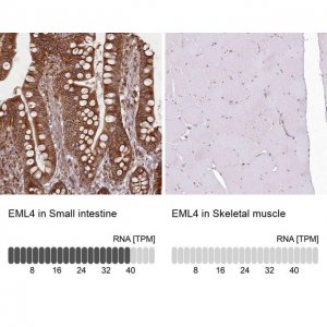 Anti-EML4 antibody produced in rabbit 