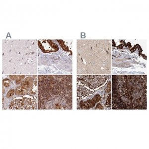 Anti-EML4 antibody produced in rabbit 