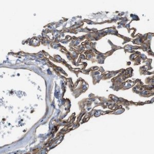 Anti-EMP2 antibody produced in rabbit 