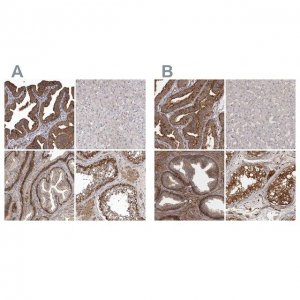 Anti-ENAH antibody produced in rabbit 
