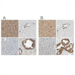 Anti-ENDOD1 antibody produced in rabbit 